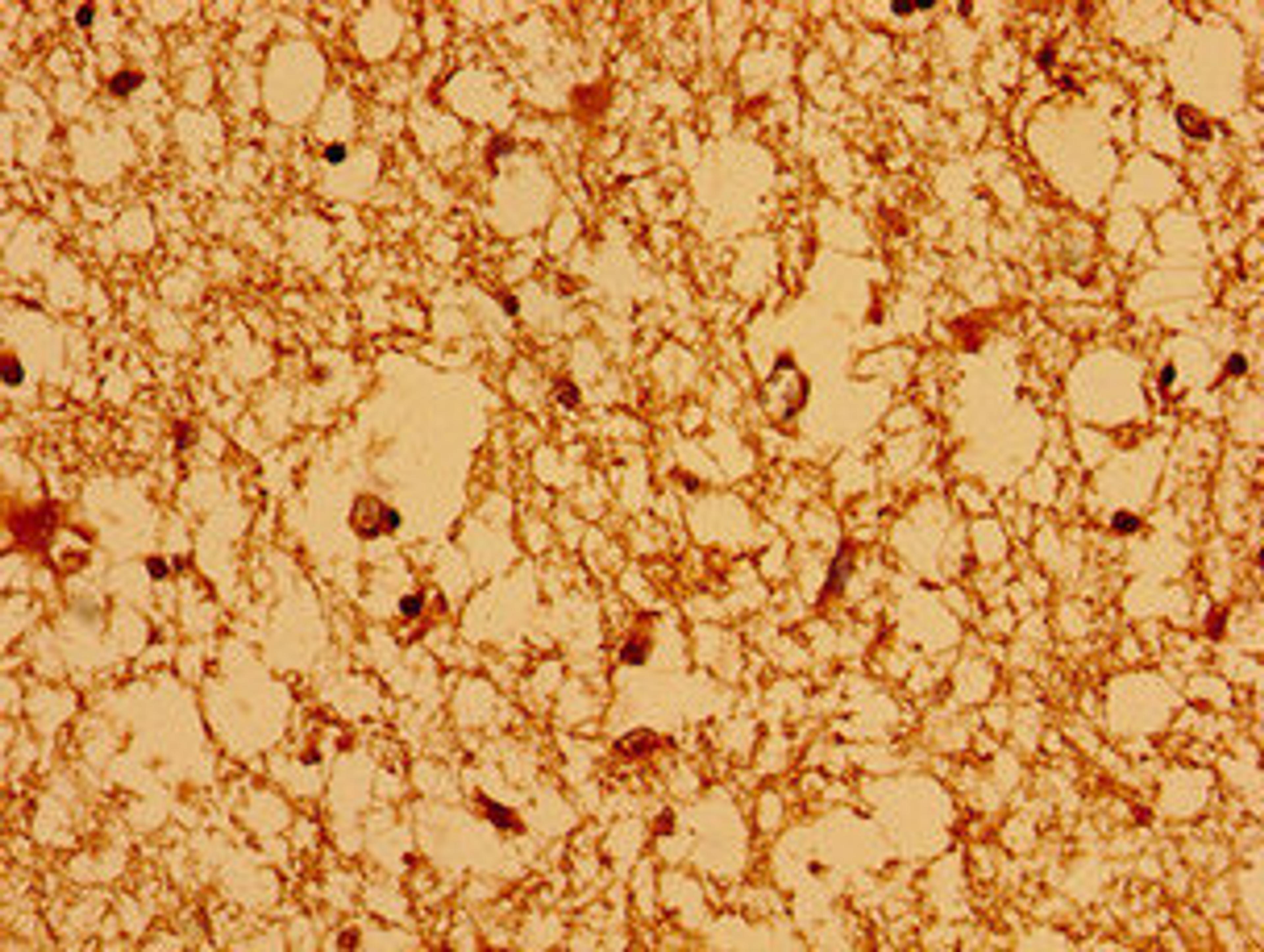 Immunohistochemistry of paraffin-embedded human brain tissue using CSB-PA897472LA01HU at dilution of 1:100