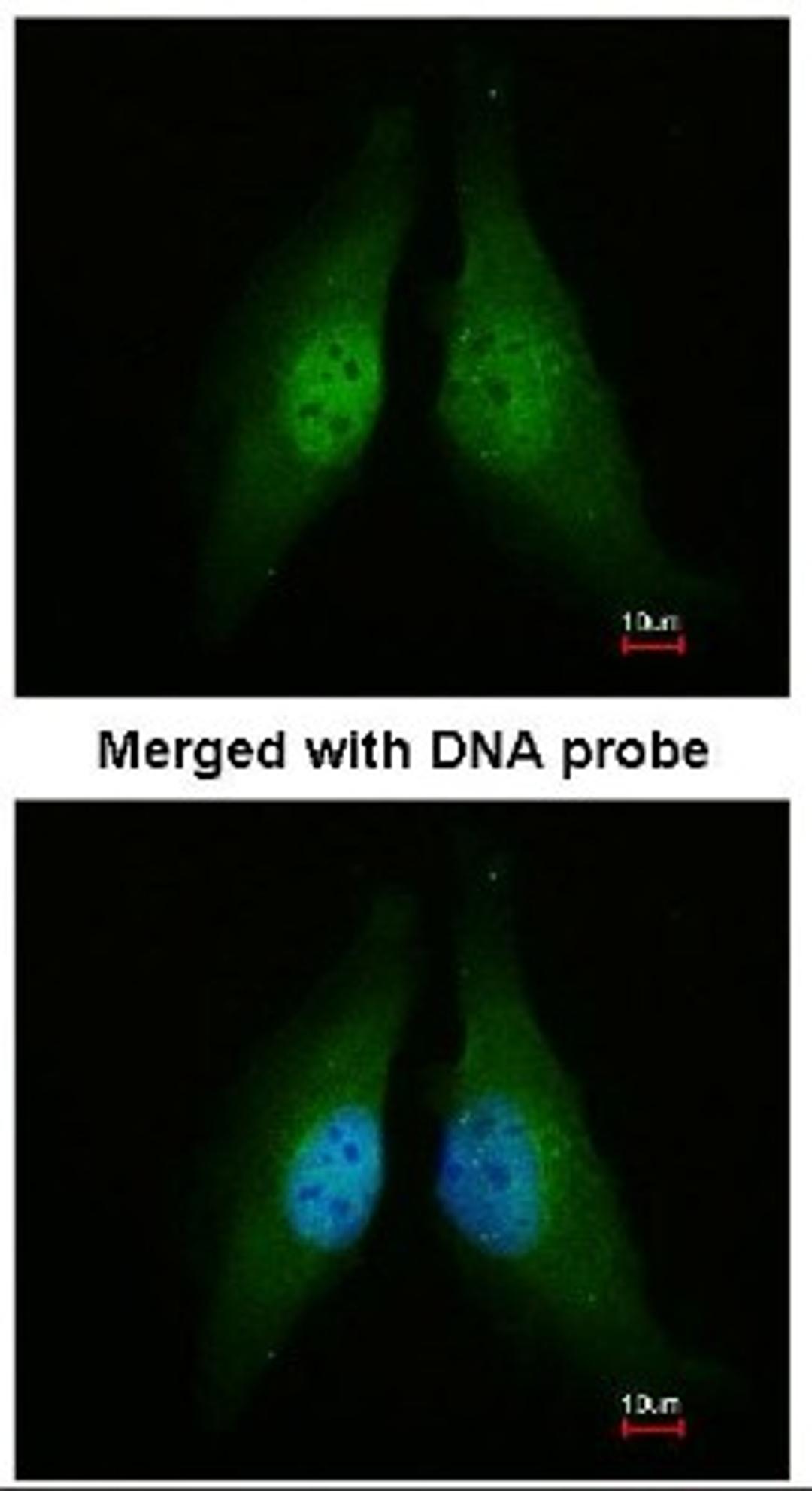 Immunocytochemistry/Immunofluorescence: Cdk4 Antibody [NBP1-31308] - Analysis of HeLa, using CDK4 antibody at 1:200 dilution.