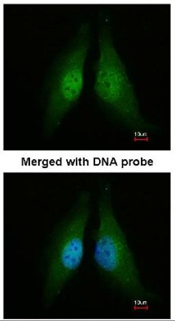 Immunocytochemistry/Immunofluorescence: Cdk4 Antibody [NBP1-31308] - Analysis of HeLa, using CDK4 antibody at 1:200 dilution.