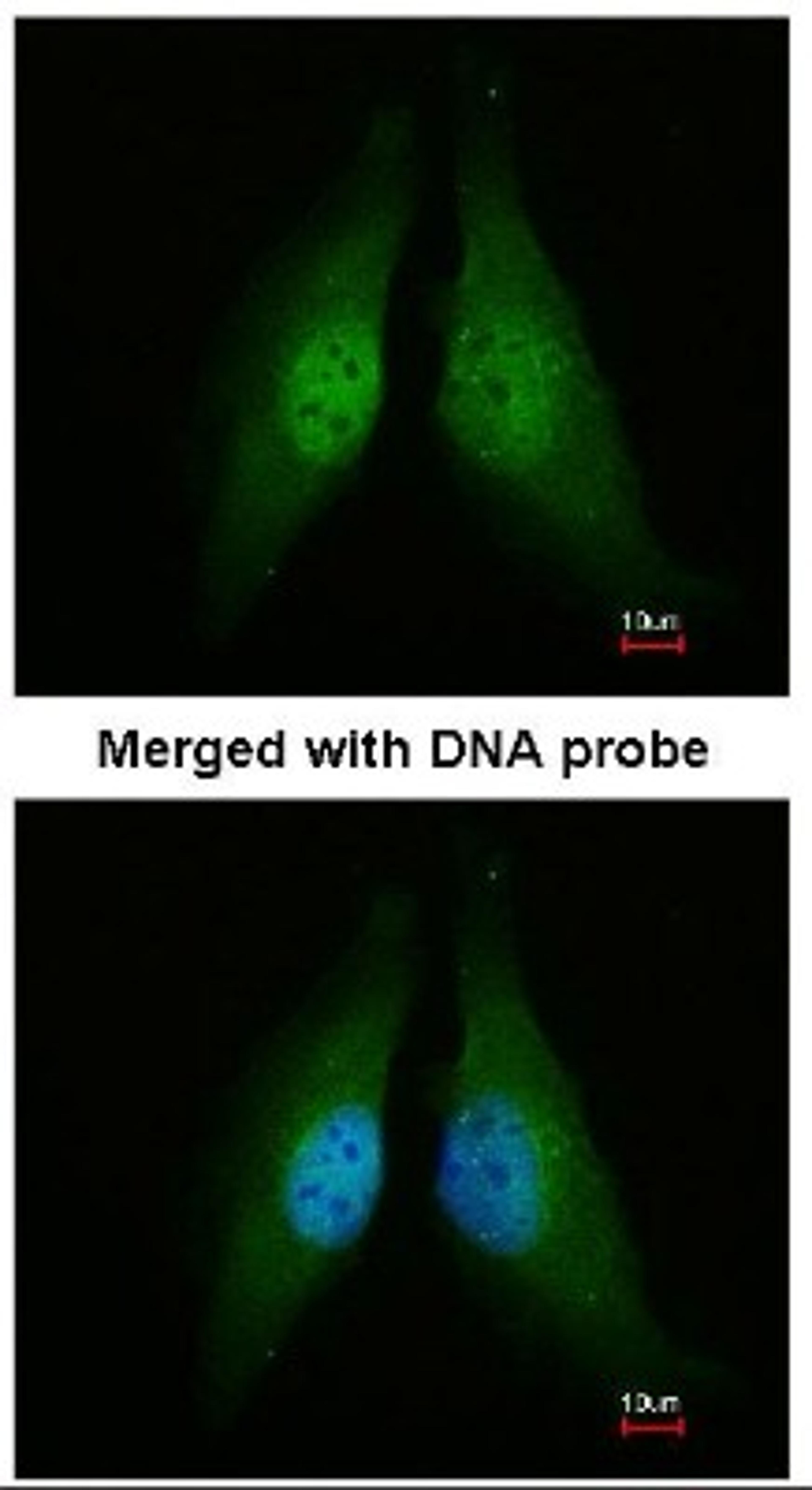 Immunocytochemistry/Immunofluorescence: Cdk4 Antibody [NBP1-31308] - Analysis of HeLa, using CDK4 antibody at 1:200 dilution.