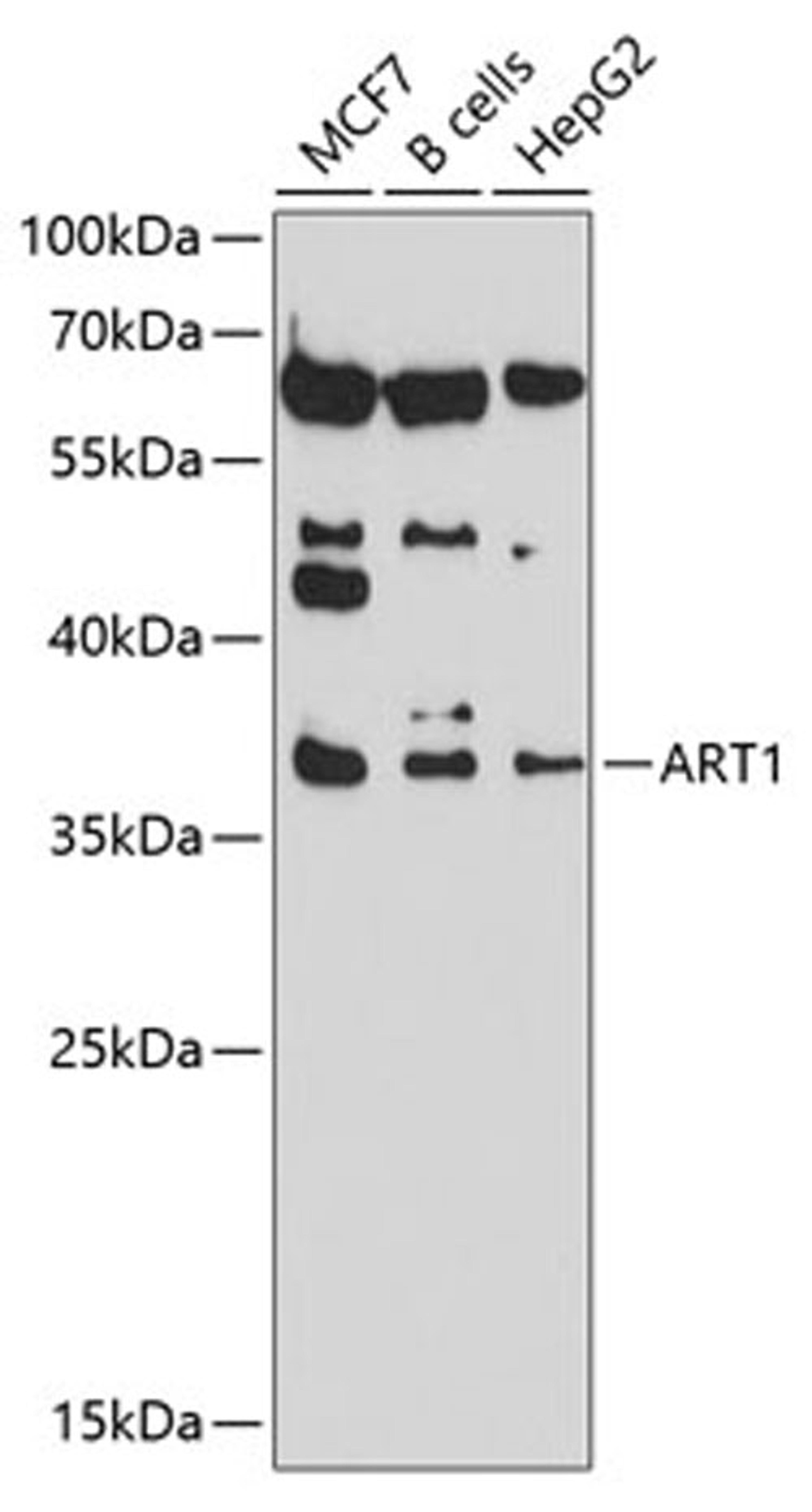 Western blot - ART1 antibody (A10103)