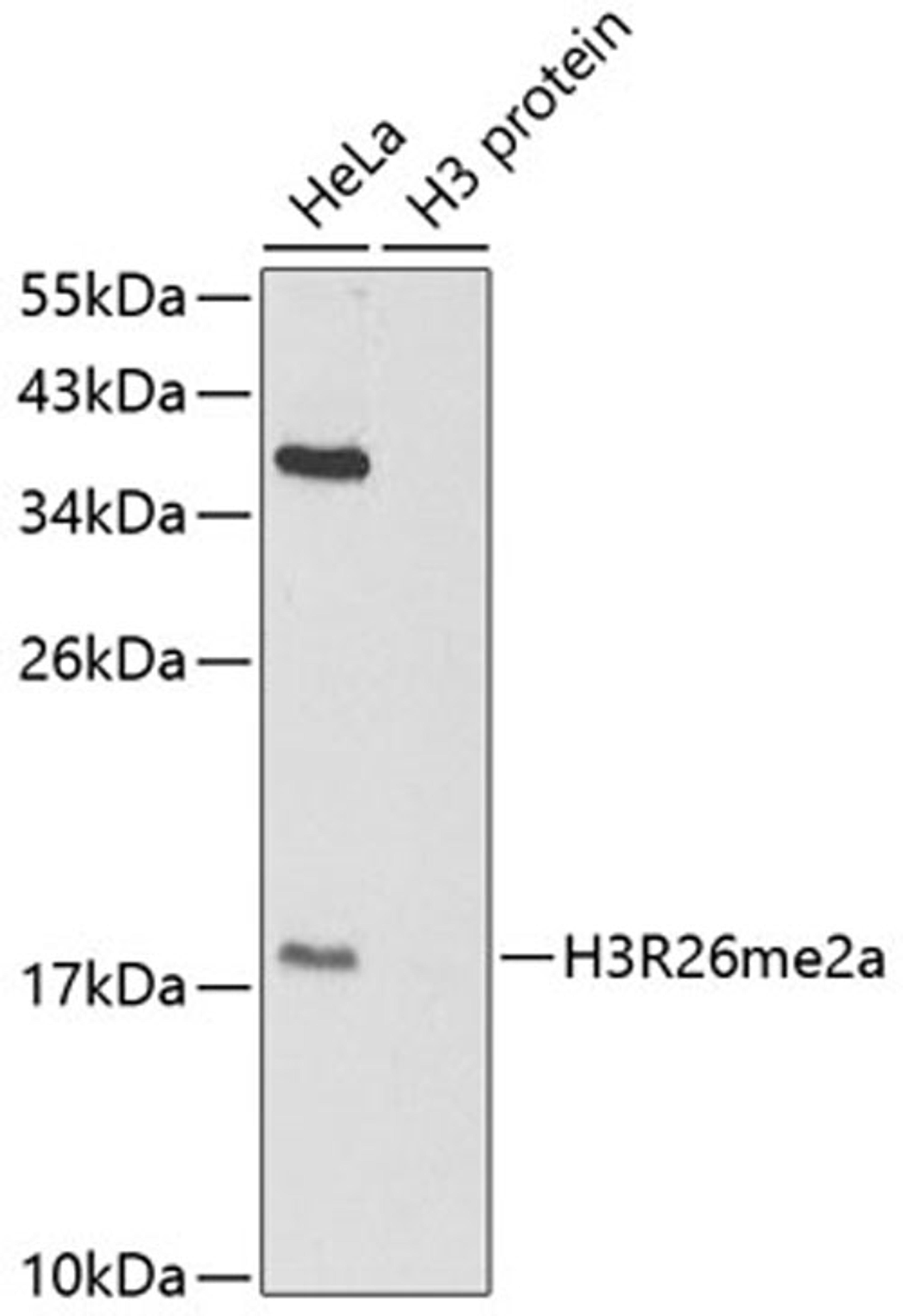 Western blot - Asymmetric DiMethyl-Histone H3-R26 antibody (A2375)