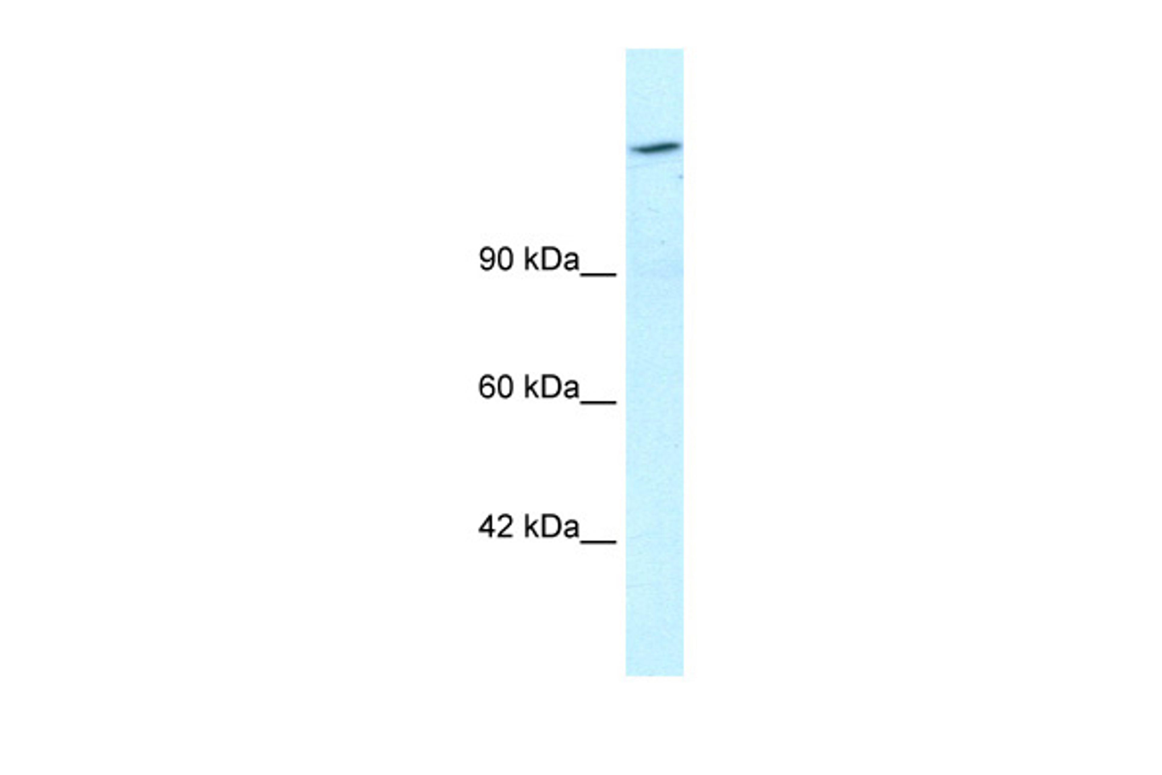 Antibody used in WB on Human HepG2 at 1.25 ug/ml.