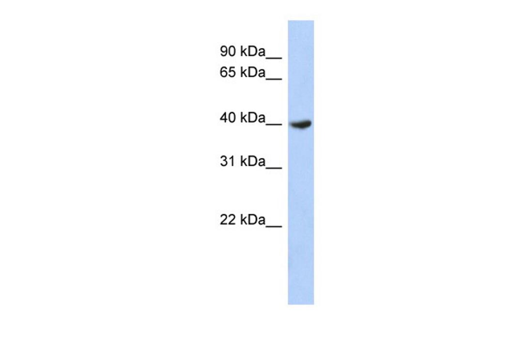 Antibody used in WB on Human NCI-H226 at 0.2-1 ug/ml.