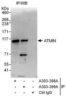 Detection of human ATMIN by western blot of immunoprecipitates.