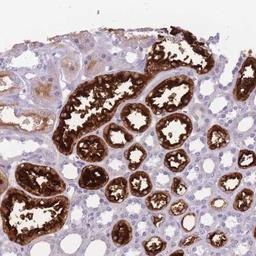 Immunohistochemistry: GGT1 Antibody [NBP2-46750] - Analysis of human kidney shows strong cytoplasmic and membranous positivity in tubular cells.