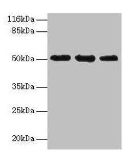 Western blot. All lanes: KRT38 antibody at 2µg/ml. Lane 1: MCF-7 whole cell lysate. Lane 2: Hela whole cell lysate. Lane 3: HepG2 whole cell lysate. Secondary. Goat polyclonal to rabbit IgG at 1/10000 dilution. Predicted band size: 51 kDa. Observed band size: 51 kDa