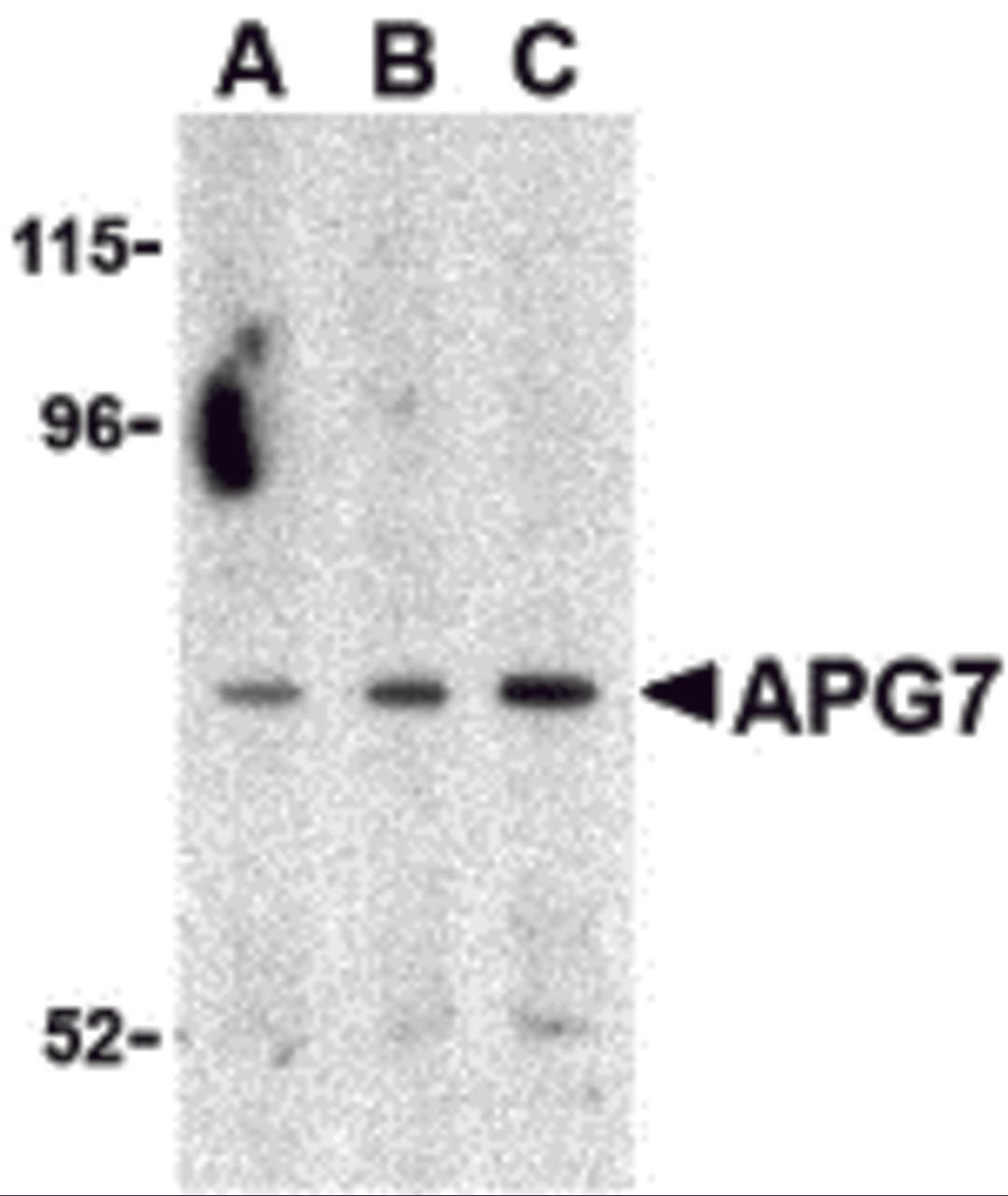 Western blot analysis of APG7 in Caco-2 cell lysate with APG7 antibody at (A) 0.5, (B) 1 and (C) 2 μg/mL.