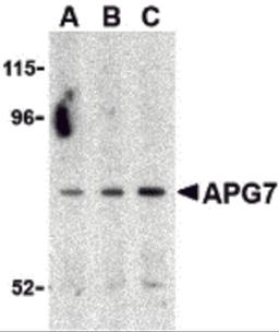 Western blot analysis of APG7 in Caco-2 cell lysate with APG7 antibody at (A) 0.5, (B) 1 and (C) 2 μg/mL.