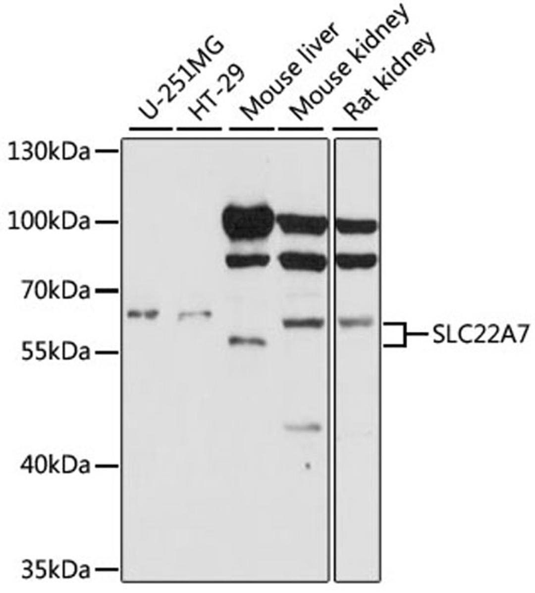 Western blot - SLC22A7 antibody (A15137)