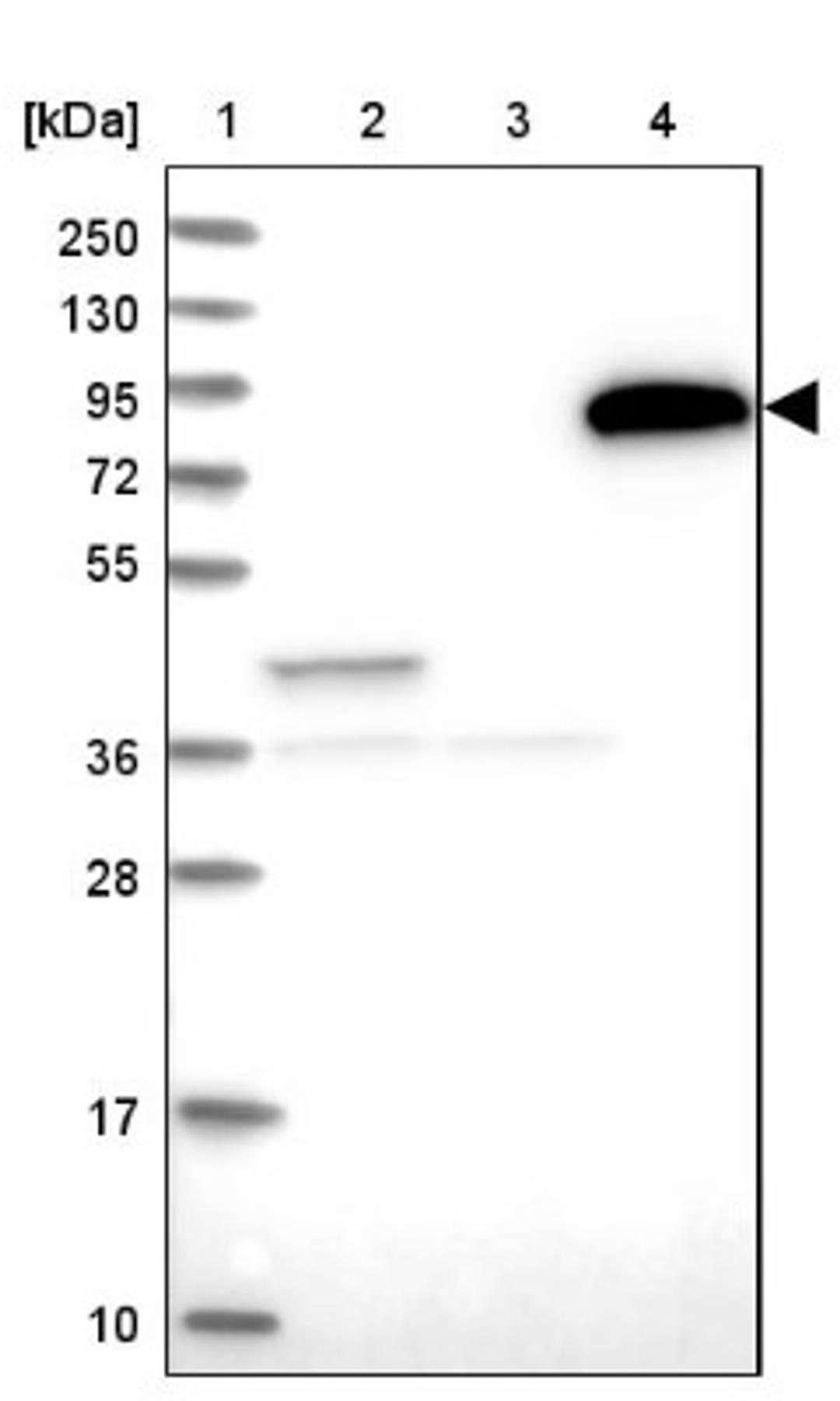 Western Blot: NCKAP5L Antibody [NBP1-93583] - Lane 1: Marker [kDa] 250, 130, 95, 72, 55, 36, 28, 17, 10<br/>Lane 2: Human cell line RT-4<br/>Lane 3: Human cell line U-251MG sp<br/>Lane 4: Human plasma (IgG/HSA depleted)