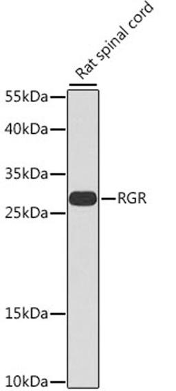 Western blot - RGR antibody (A7925)