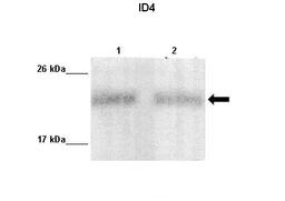 Antibody used in WB on MDA-MB231, MCF7 at 1:1000 (Lane 1: 10ug MDA-MB231 lysate, Lane 2: 10ug MCF7 lysate ).