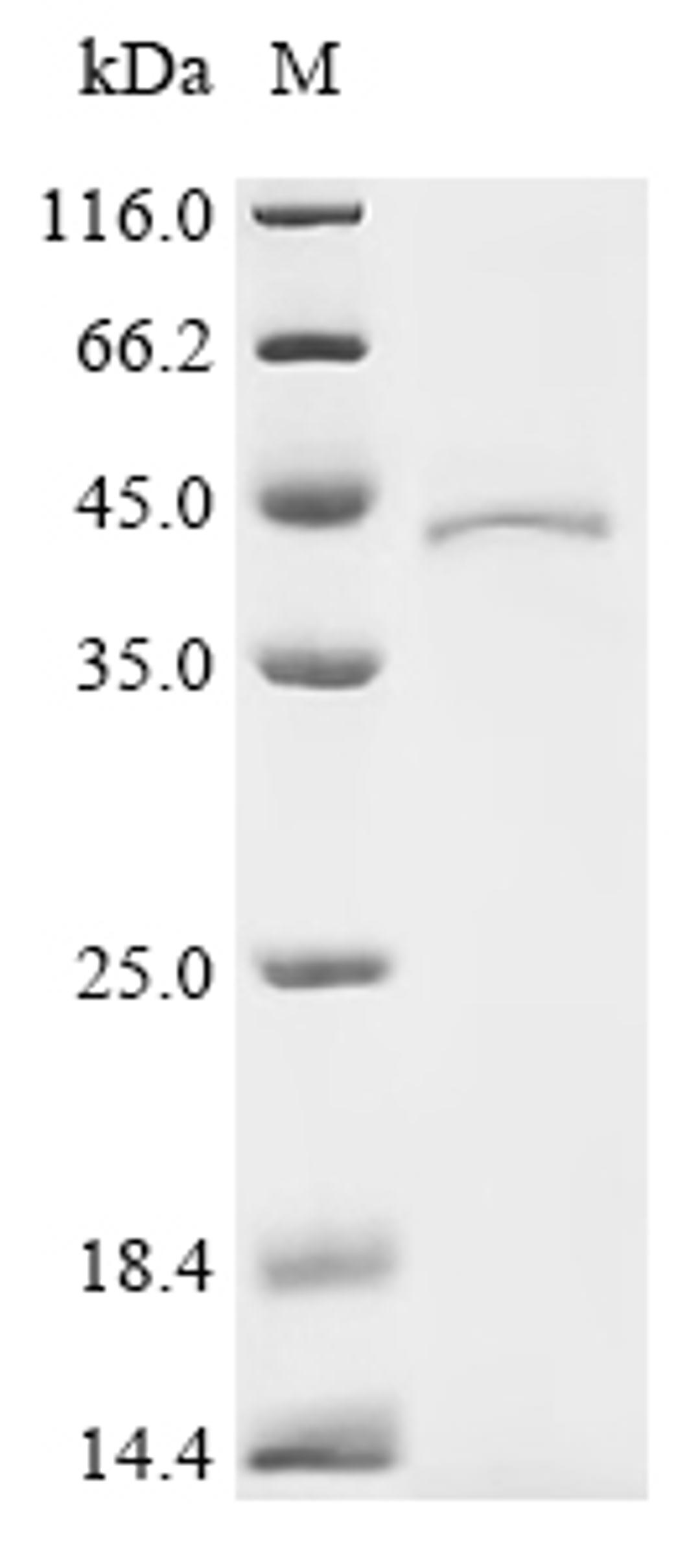 (Tris-Glycine gel) Discontinuous SDS-PAGE (reduced) with 5% enrichment gel and 15% separation gel.