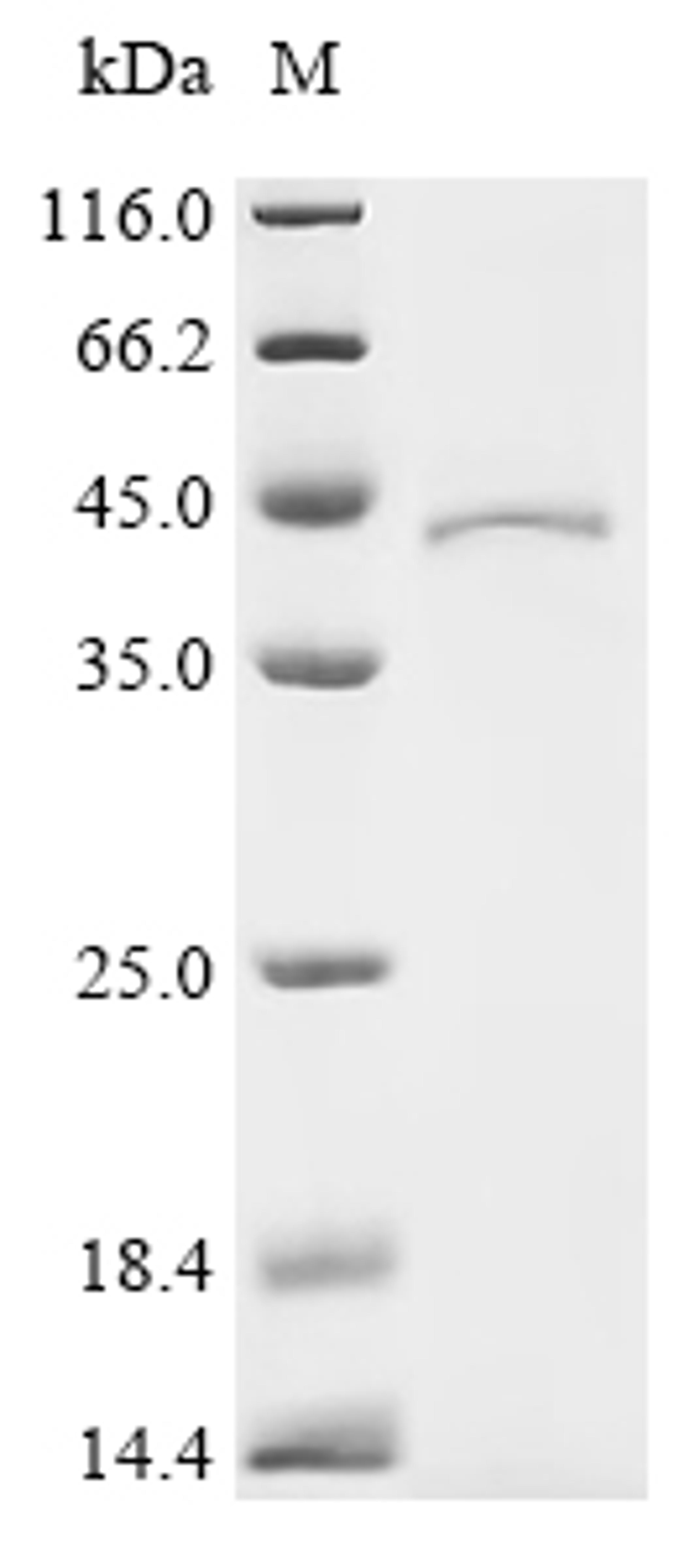 (Tris-Glycine gel) Discontinuous SDS-PAGE (reduced) with 5% enrichment gel and 15% separation gel.