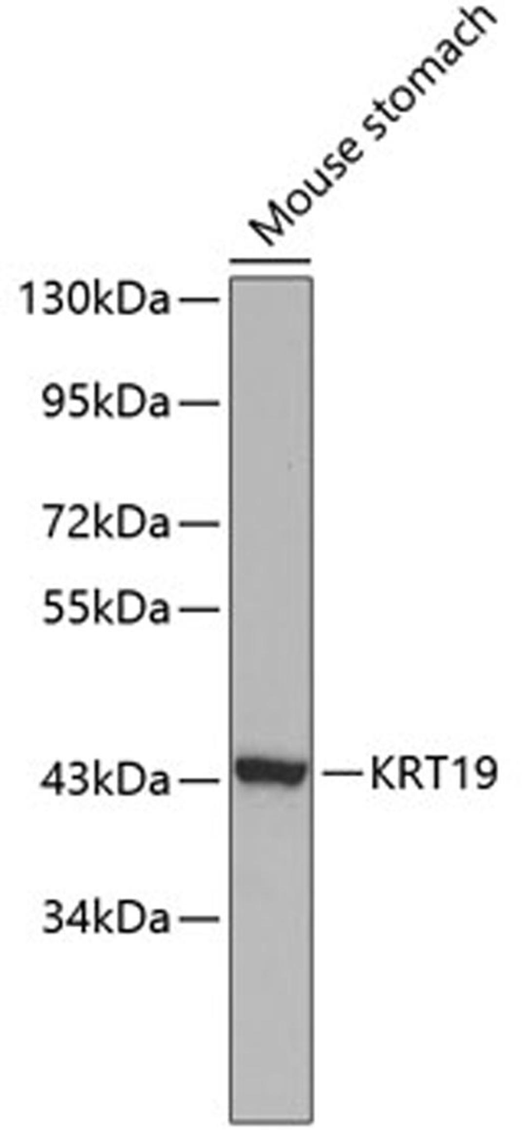 Western blot - KRT19 antibody (A0247)