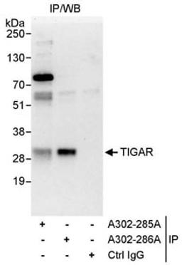 Detection of human TIGAR by western blot of immunoprecipitates.