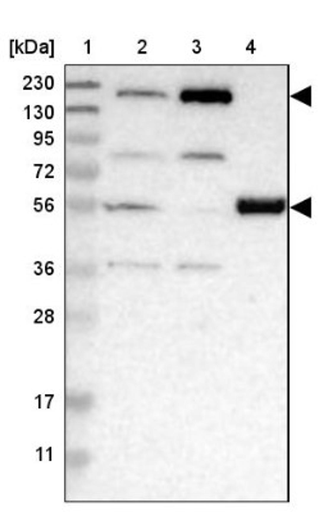 Western Blot: WHSC1 Antibody [NBP1-82633] - Lane 1: Marker [kDa] 230, 130, 95, 72, 56, 36, 28, 17, 11<br/>Lane 2: Human cell line RT-4<br/>Lane 3: Human cell line U-251MG sp<br/>Lane 4: Human plasma (IgG/HSA depleted)