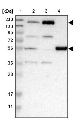 Western Blot: WHSC1 Antibody [NBP1-82633] - Lane 1: Marker [kDa] 230, 130, 95, 72, 56, 36, 28, 17, 11<br/>Lane 2: Human cell line RT-4<br/>Lane 3: Human cell line U-251MG sp<br/>Lane 4: Human plasma (IgG/HSA depleted)