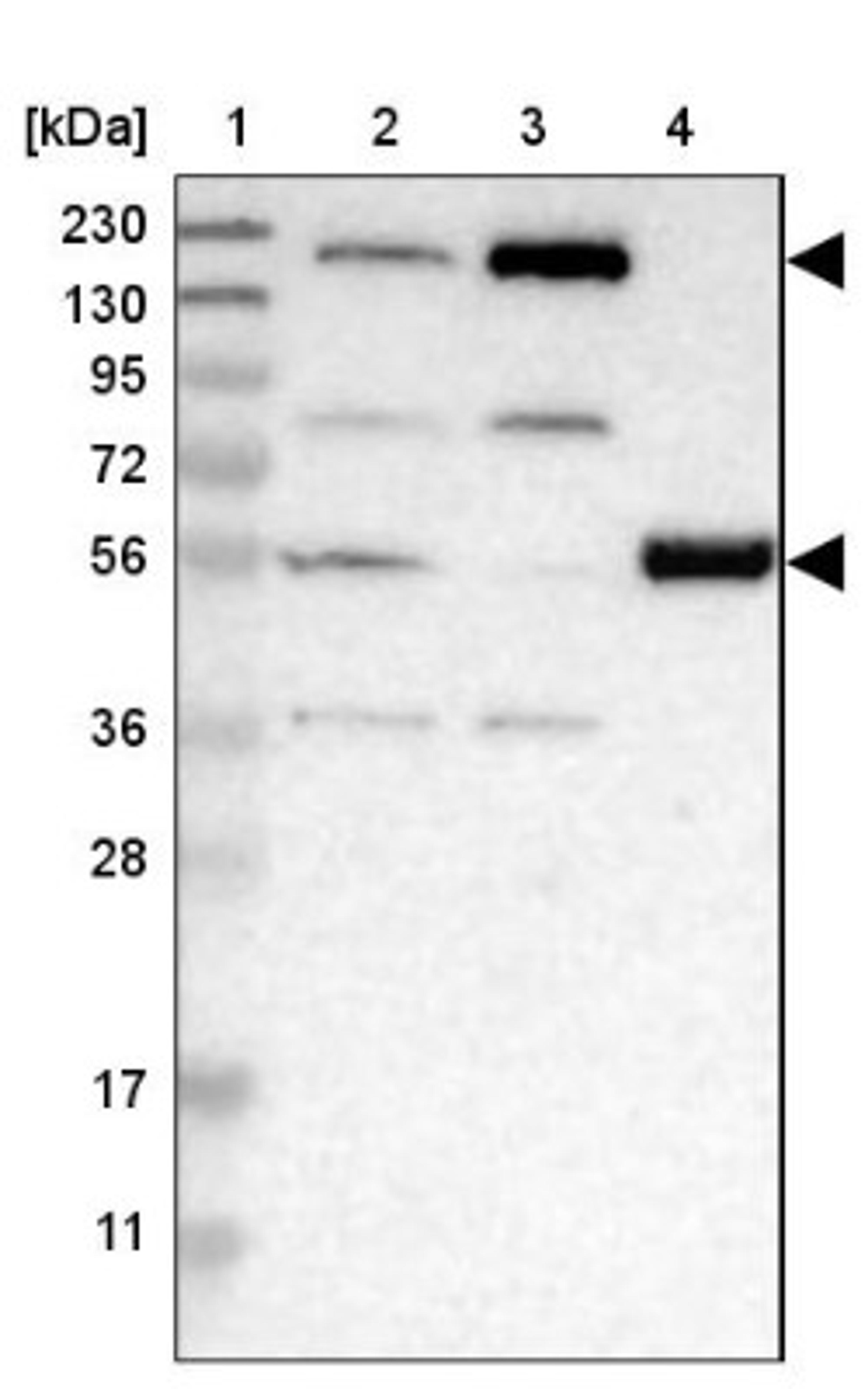 Western Blot: WHSC1 Antibody [NBP1-82633] - Lane 1: Marker [kDa] 230, 130, 95, 72, 56, 36, 28, 17, 11<br/>Lane 2: Human cell line RT-4<br/>Lane 3: Human cell line U-251MG sp<br/>Lane 4: Human plasma (IgG/HSA depleted)