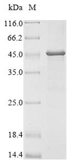 (Tris-Glycine gel) Discontinuous SDS-PAGE (reduced) with 5% enrichment gel and 15% separation gel.