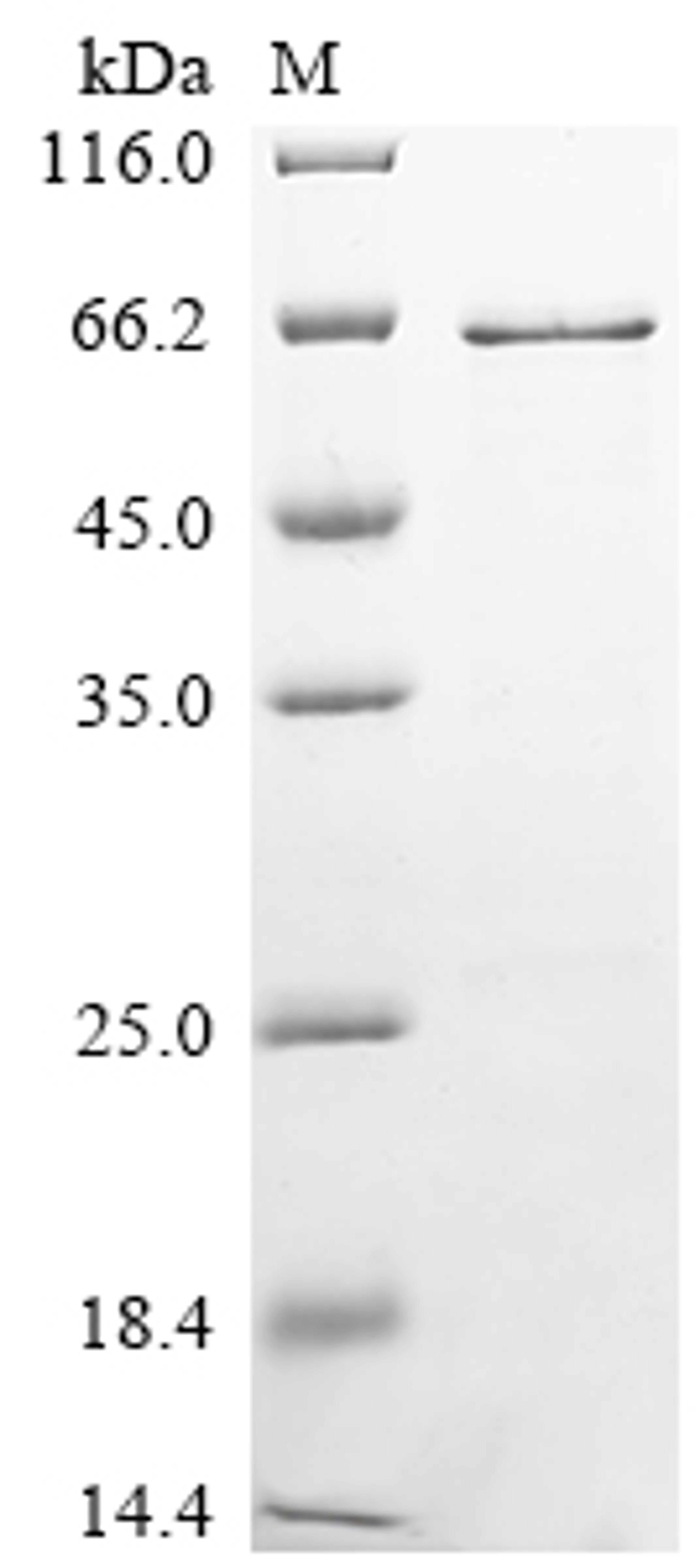 (Tris-Glycine gel) Discontinuous SDS-PAGE (reduced) with 5% enrichment gel and 15% separation gel.