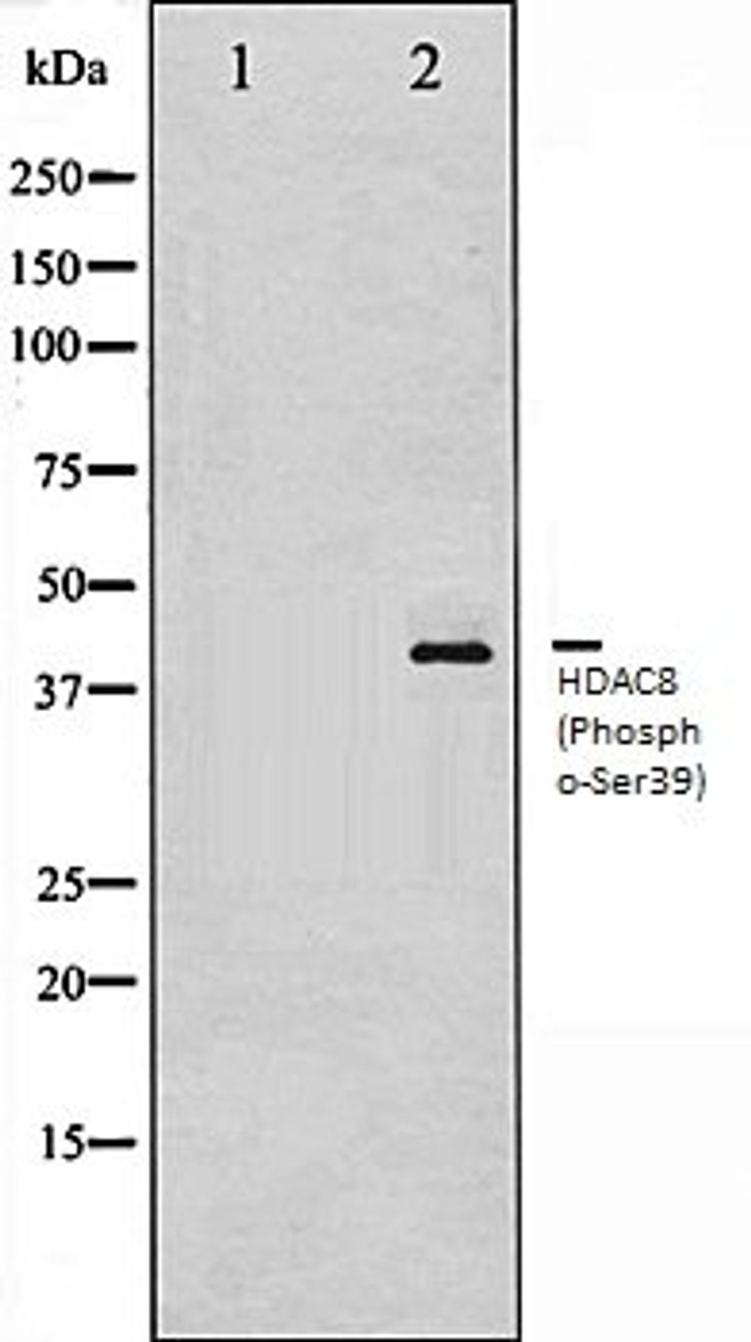 Western blot analysis of NIH-3T3 whole cell lysates using HDAC8 (Phospho-Ser39) antibody, The lane on the left is treated with the antigen-specific peptide.