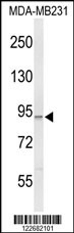 Western blot analysis of PIK3CG Antibody in MDA-MB231 cell line lysates (35ug/lane)