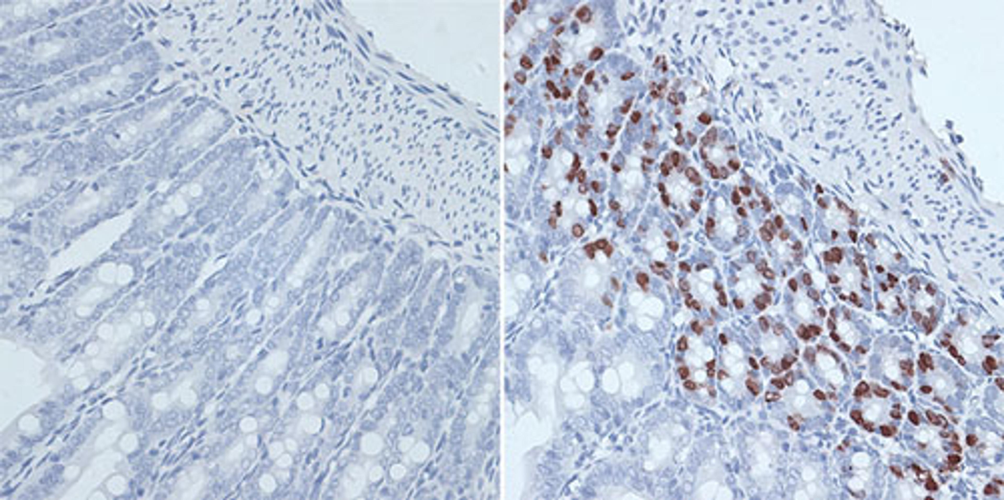Immunohistochemistry - BrdU antibody (A1482)