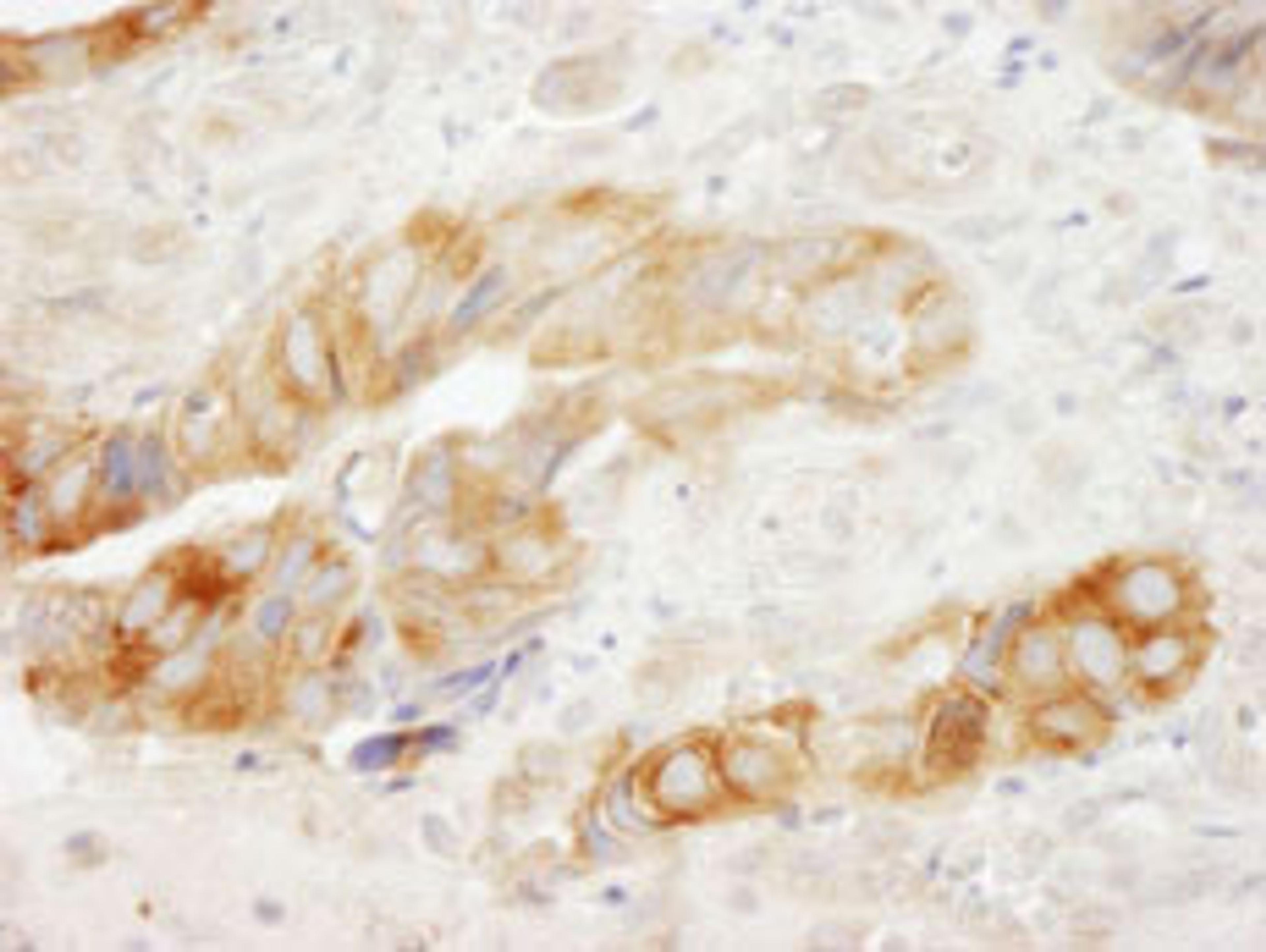 Detection of human eEF1G by immunohistochemistry.