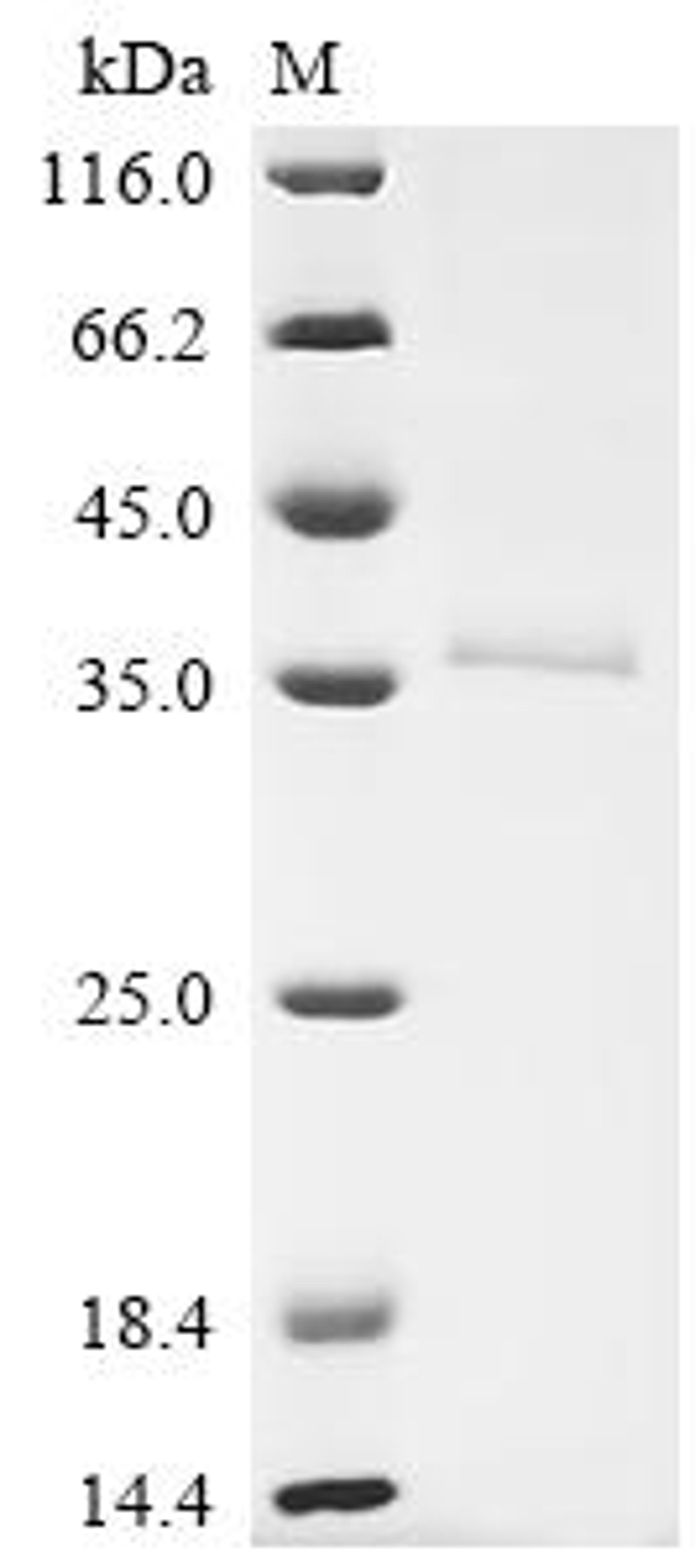 (Tris-Glycine gel) Discontinuous SDS-PAGE (reduced) with 5% enrichment gel and 15% separation gel.