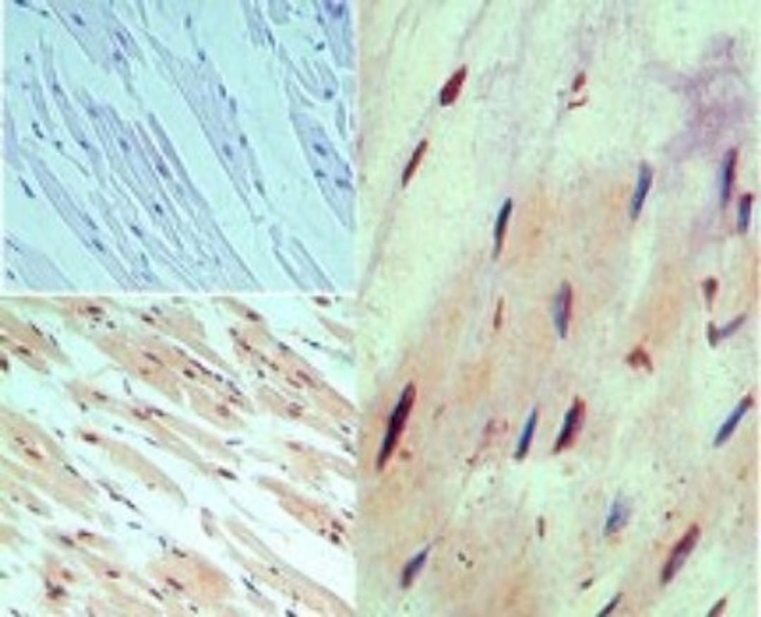 Immunohistochemistry-Paraffin: MUC13 Antibody [NBP2-24566] - Analysis of Mucin 13 in formalin-fixed, paraffin-embedded human heart tissue using an isotype control (top left) and NBP2-24566 (bottom left, right) at 5 ug/ml.