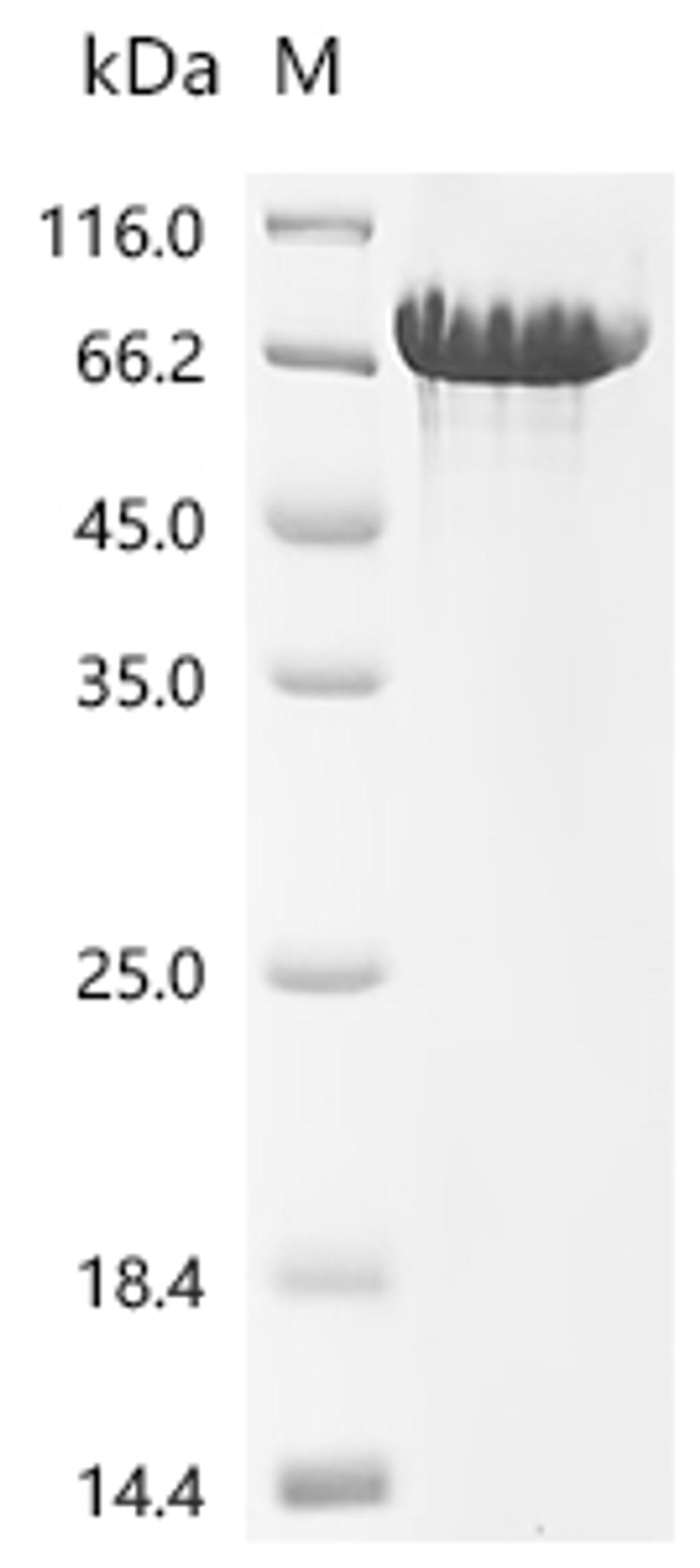 (Tris-Glycine gel) Discontinuous SDS-PAGE (reduced) with 5% enrichment gel and 15% separation gel.