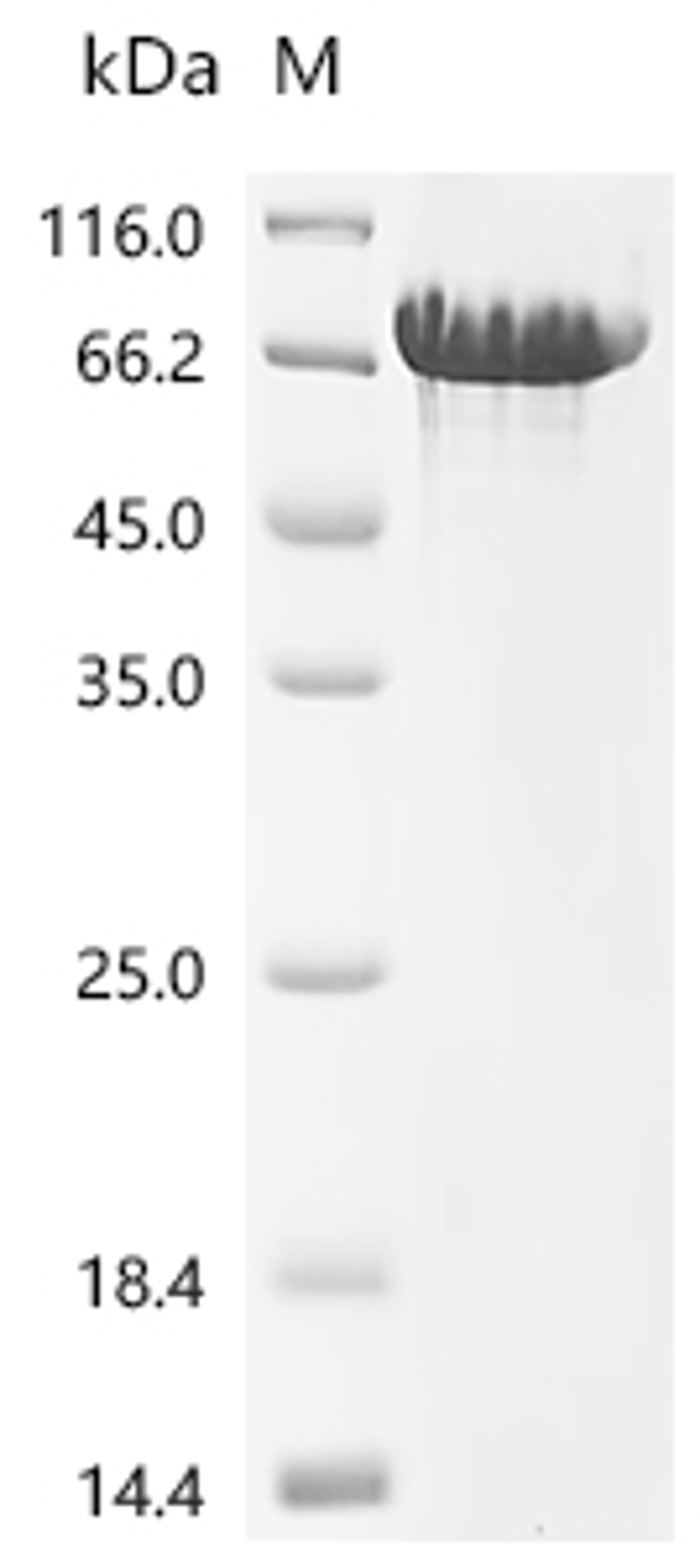 (Tris-Glycine gel) Discontinuous SDS-PAGE (reduced) with 5% enrichment gel and 15% separation gel.