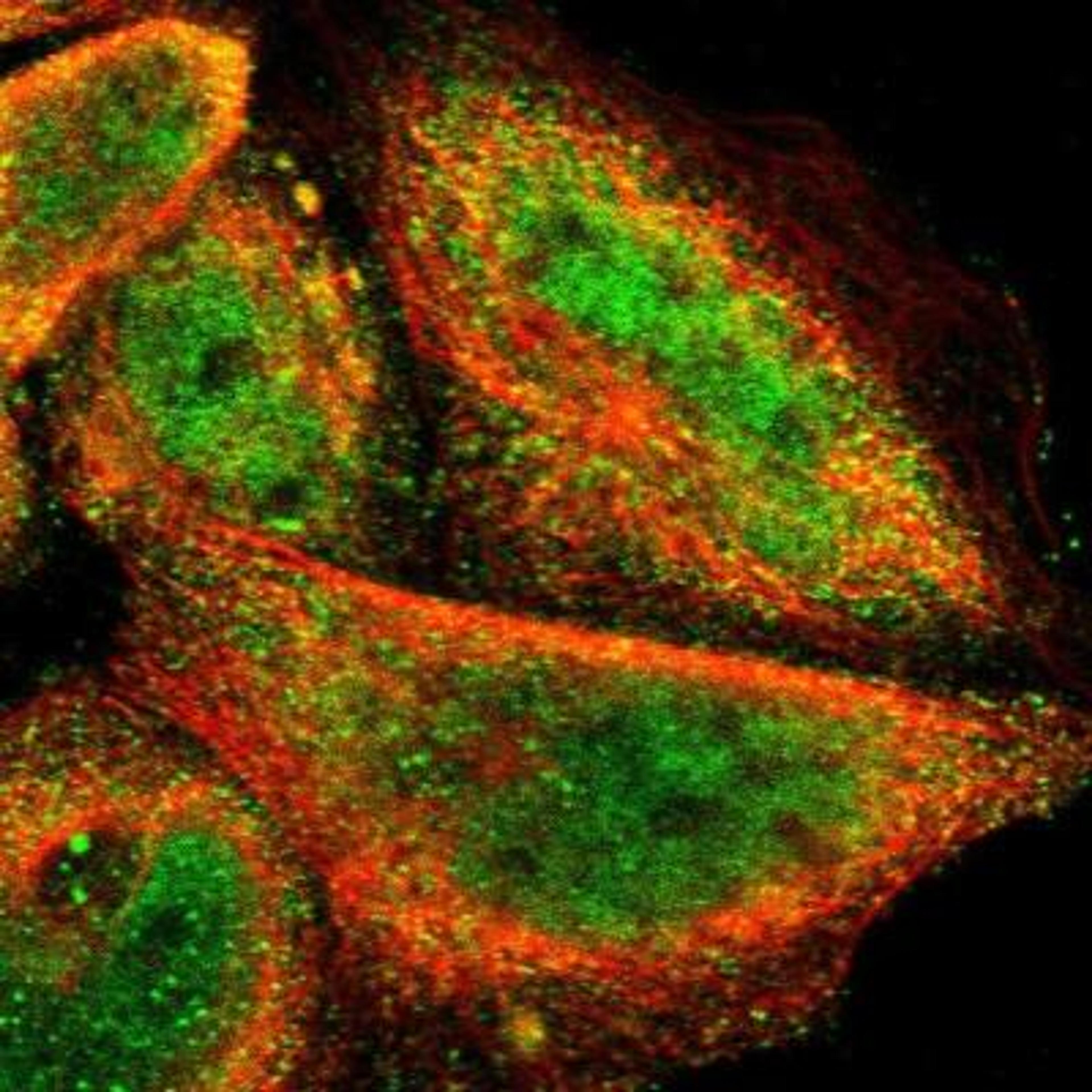 Immunocytochemistry/Immunofluorescence: FRMD7 Antibody [NBP1-93762] - Staining of human cell line A-431 shows positivity in nucleus but not nucleoli & cytoplasm.