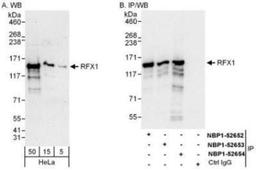 Western Blot: RFX1 Antibody [NBP1-52654] - Whole cell lysate (5, 15 and 50 mcg for WB; 1 mg for IP, 20% of IP loaded) from HeLa cells.  Affinity purified rabbit anti-RFX1 antibody  used for WB at 0.04 mcg/ml (A) and 0.4 mcg/ml (B) and used for IP at 6 mcg/mg lysate.  RFX1 was also immunoprecipitated by rabbit anti-RFX1 antibodies NBP1-52652 and NBP1-52653, which recognize upstream epitopes.