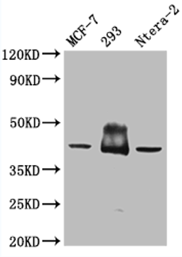 Western Blot. Positive WB detected in: Mouse brain tissue. All lanes: S1PR2 antibody at 3ug/ml. Secondary. Goat polyclonal to rabbit IgG at 1/50000 dilution. Predicted band size: 39 kDa. Observed band size: 39 kDa. 