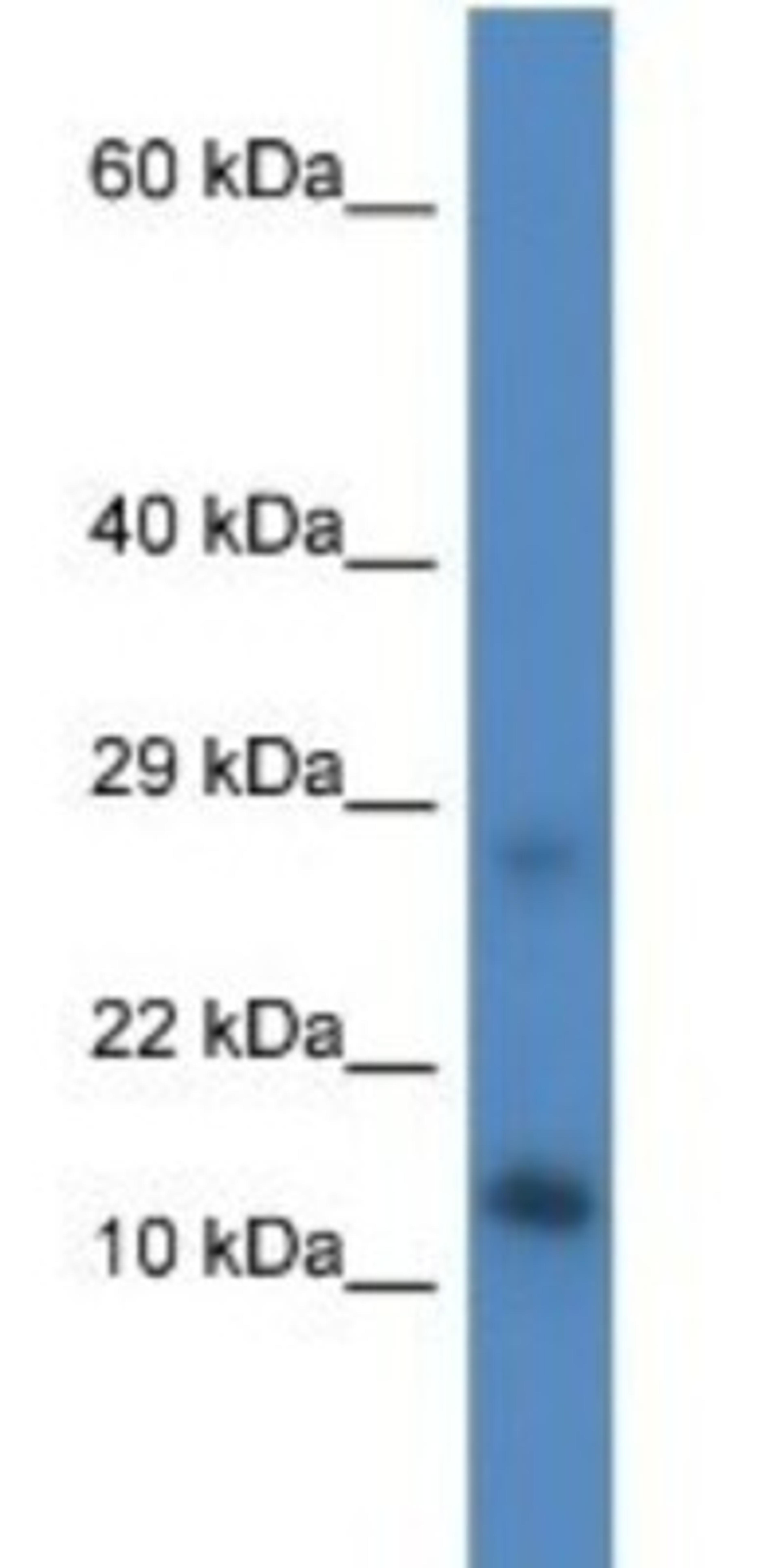 Western Blot: LYRM4 Antibody [NBP1-79672] - Mouse Liver Lysate 1ug/ml  Gel Concentration 10-20%