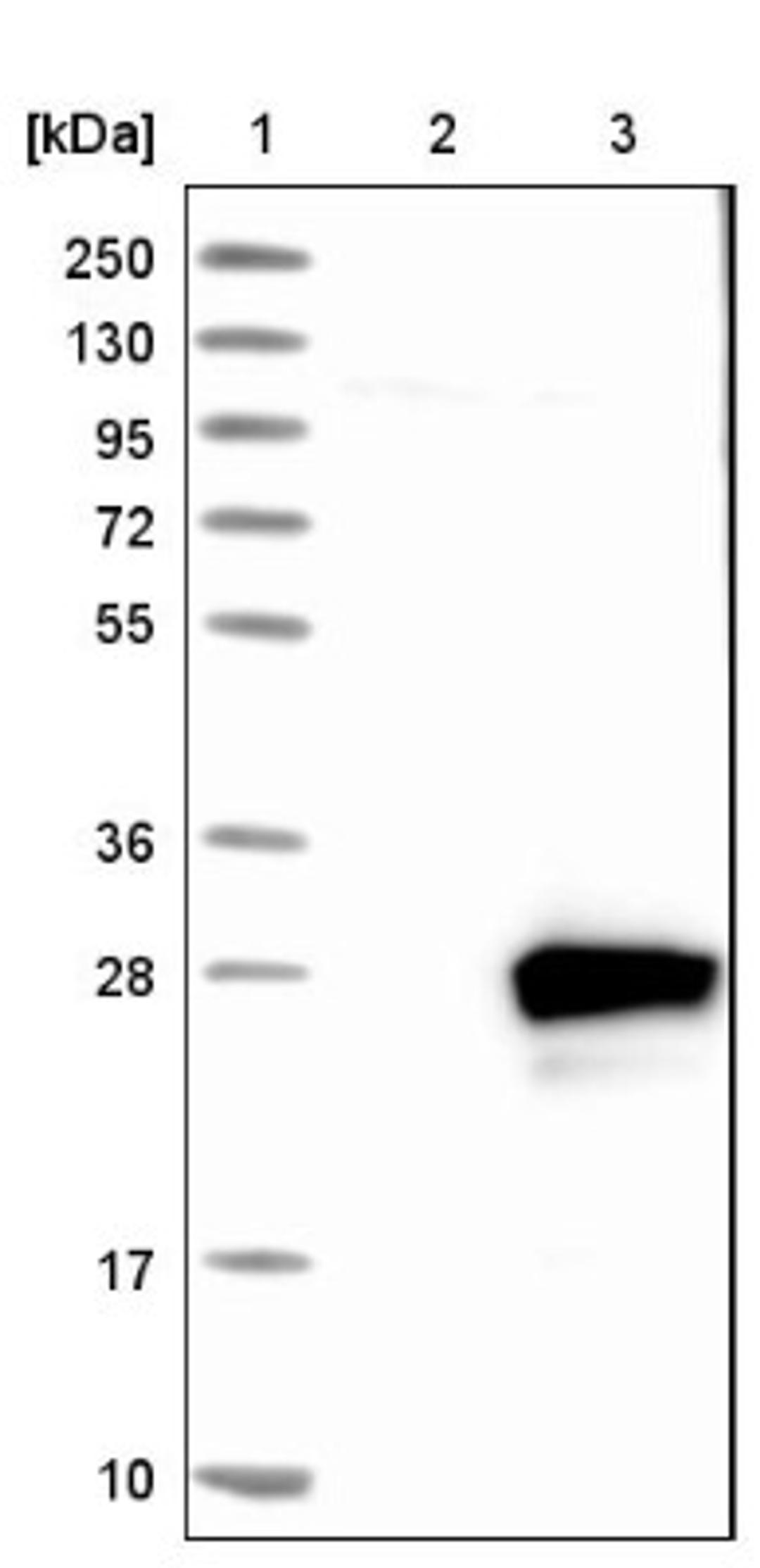 Western Blot: RAB7L1 Antibody [NBP1-87173] - Lane 1: Marker [kDa] 250, 130, 95, 72, 55, 36, 28, 17, 10<br/>Lane 2: Negative control (vector only transfected HEK293T lysate)<br/>Lane 3: Over-expression lysate (Co-expressed with a C-terminal myc-DDK tag (~3.1 kDa) in mammalian HEK293T cells, LY418334)