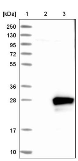 Western Blot: RAB7L1 Antibody [NBP1-87173] - Lane 1: Marker [kDa] 250, 130, 95, 72, 55, 36, 28, 17, 10<br/>Lane 2: Negative control (vector only transfected HEK293T lysate)<br/>Lane 3: Over-expression lysate (Co-expressed with a C-terminal myc-DDK tag (~3.1 kDa) in mammalian HEK293T cells, LY418334)