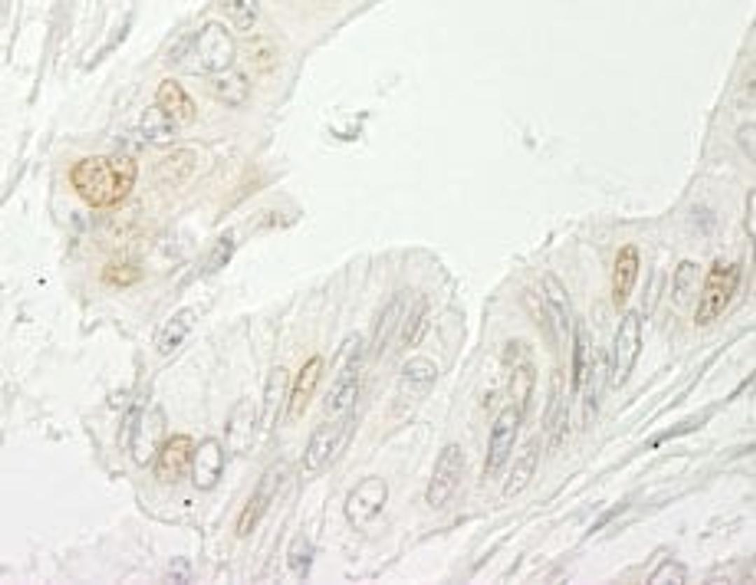 Detection of human RBM10 by immunohistochemistry.