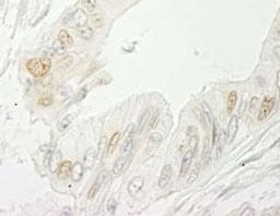 Detection of human RBM10 by immunohistochemistry.