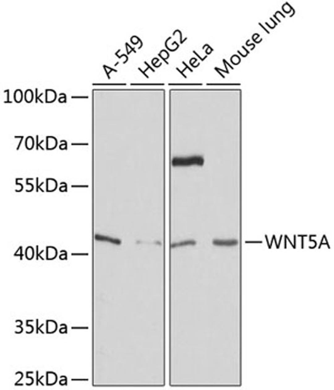 Western blot - WNT5A antibody (A12744)