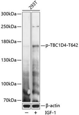 Western blot - Phospho-TBC1D4-T642 antibody (AP0791)