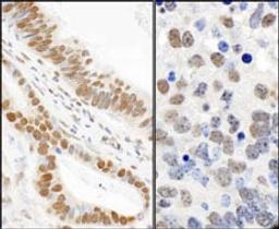 Detection of human and mouse Phospho 53BP1 (S25) by immunohistochemistry.