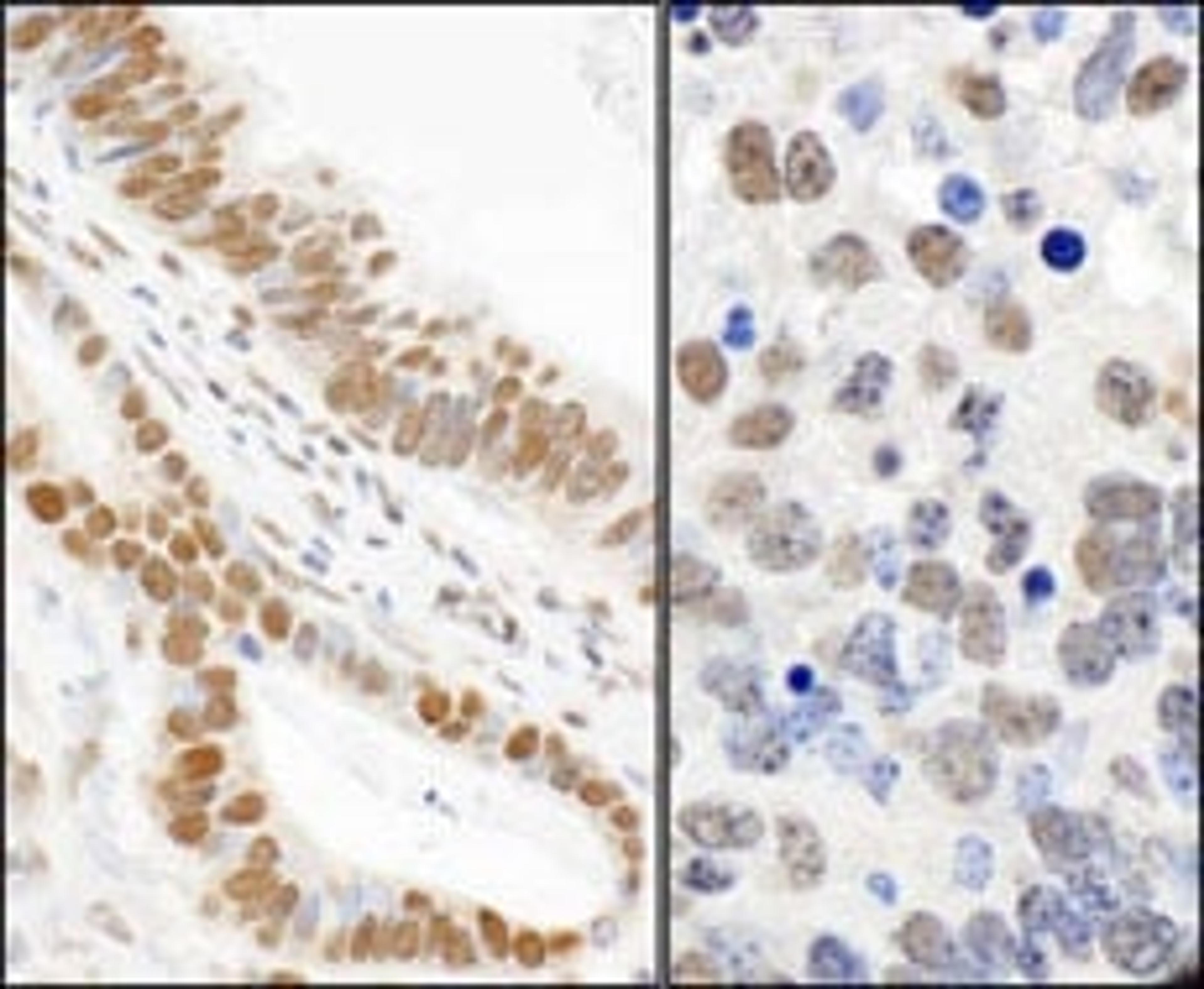 Detection of human and mouse Phospho 53BP1 (S25) by immunohistochemistry.