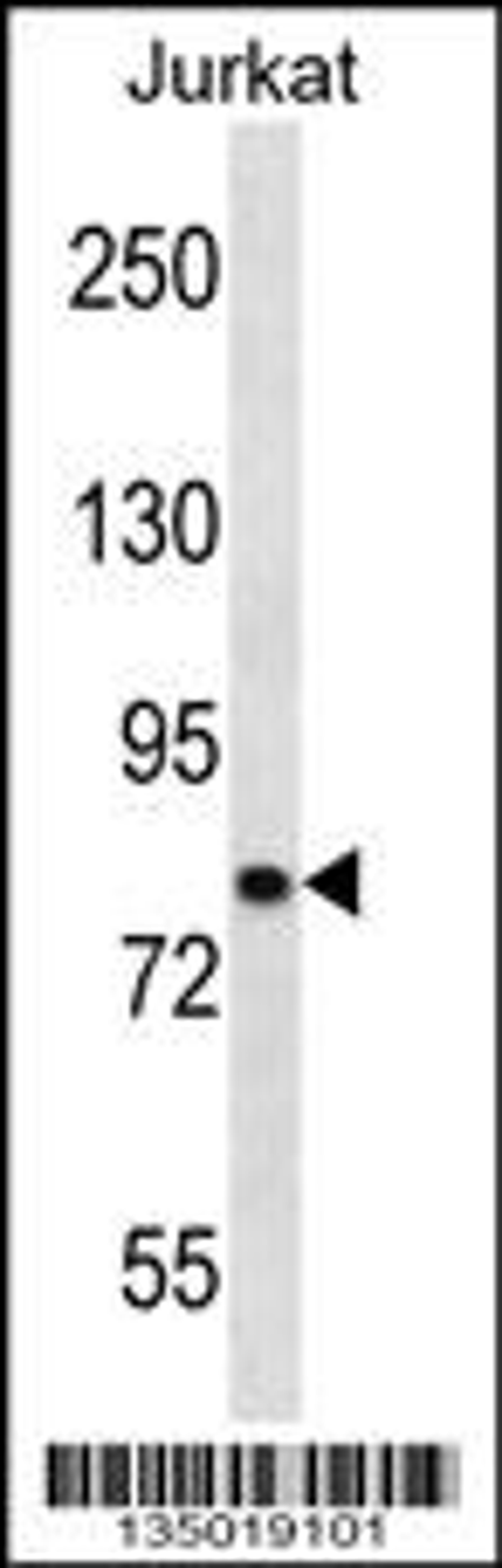 Western blot analysis in Jurkat cell line lysates (35ug/lane).