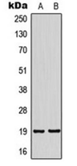 Western blot analysis of SHSY5Y (Lane 1), HeLa (Lane 2) whole cell lysates using NSG2 antibody