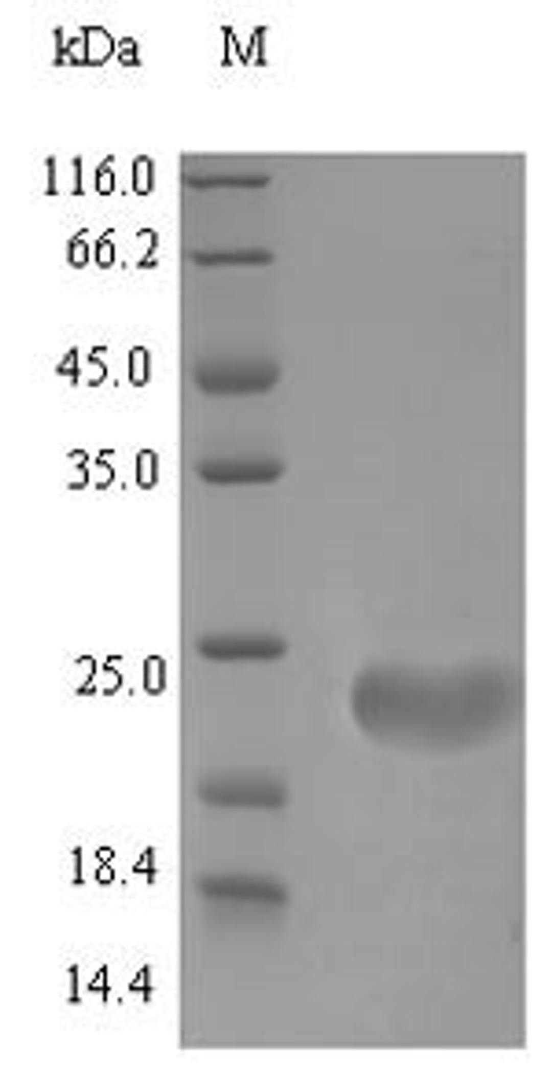 (Tris-Glycine gel) Discontinuous SDS-PAGE (reduced) with 5% enrichment gel and 15% separation gel.