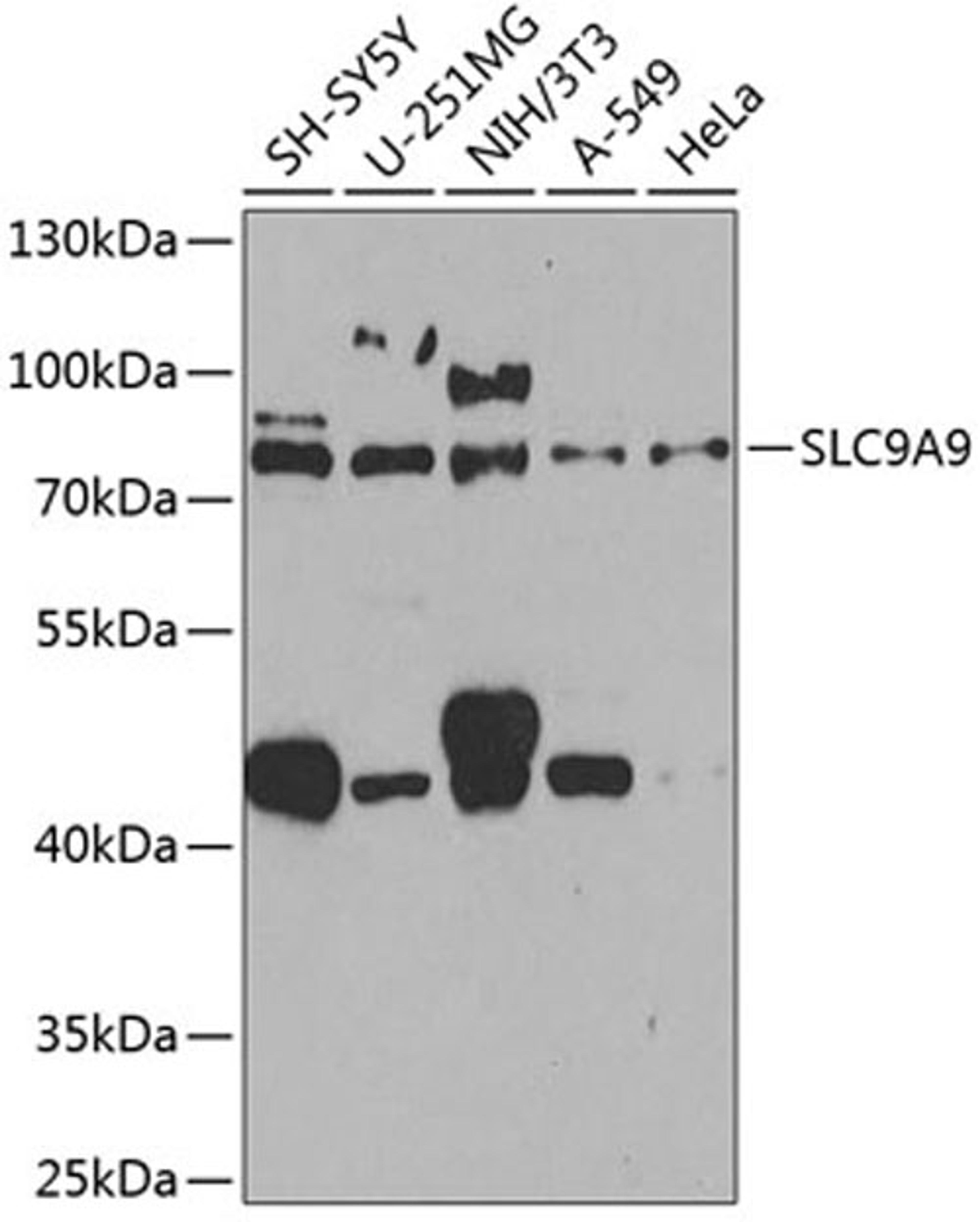 Western blot - SLC9A9 antibody (A8323)